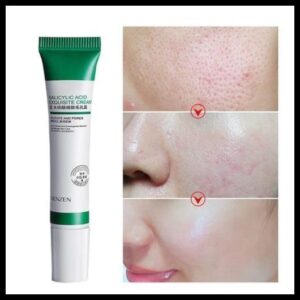 Creme De Ácido Salicílico 20ml Para Remoção E Clareamento De Poros/Acne/Controle De Óleo /