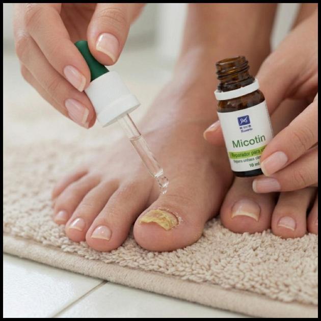 Micose de Unhas Micotin 10ml Conta Gotas - Reparador Para Unhas Com Fungos